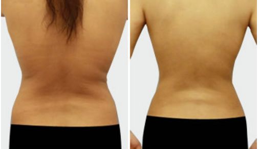 名醫(yī)孟祥宏師傅：創(chuàng)造完美鼻型的心靈藝術！