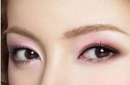 北京協(xié)和醫(yī)院白明醫(yī)生的雙眼皮手術(shù)效果如何？真實案例展示給你看