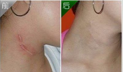 珠江醫(yī)院口碑評價_整形技術分析+隆胸案例對比圖分享