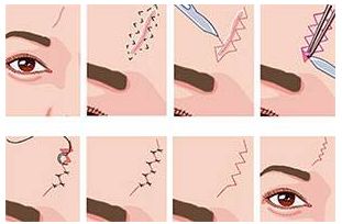 北京八大處很受推崇的隆胸醫(yī)生盤點(diǎn)  備受好評(píng)的專家推薦