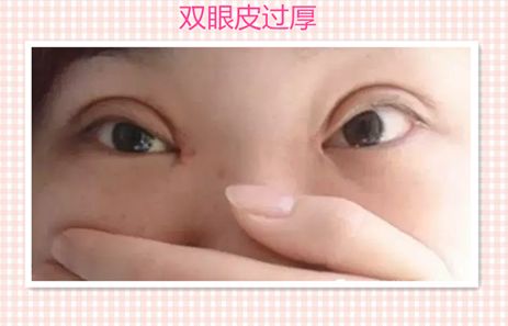 汕頭伊麗莎白醫(yī)療美容診所服務(wù)口碑分析，醫(yī)生實(shí)力深度解讀__成功案例報(bào)道