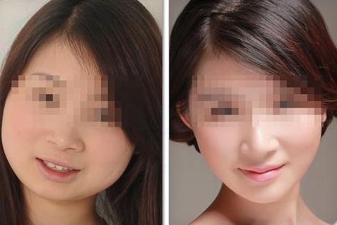 國內(nèi)備受矚目的小拉皮手術(shù)頂級專家一覽