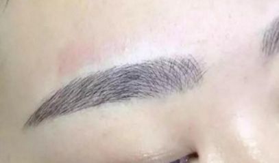 長(zhǎng)沙何瑋醫(yī)生匠心獨(dú)具，驚艷的雙眼皮效果案例匯總