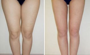 北京自體脂肪豐胸醫(yī)院獨領(lǐng)風(fēng)騷，這些機(jī)構(gòu)榜上有名