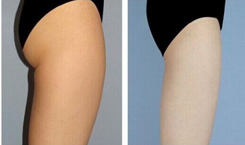 廣州著名種植牙醫(yī)生聚焦！當?shù)責衢T牙醫(yī)簡介匯總