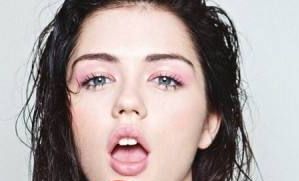 朱亞麗醫(yī)生實(shí)例分享：專業(yè)激光祛斑效果如何？