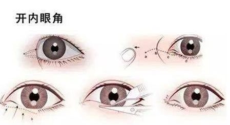 北京哪家專業(yè)醫(yī)院提供高水平的拉皮手術(shù)服務(wù)？權(quán)威機(jī)構(gòu)，口碑一流，高性價比可靠選擇！