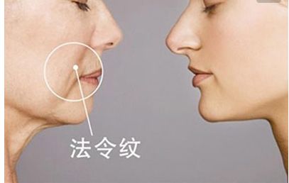 長沙田毅雙眼皮手術新穎獨特，引領2023最新潮流