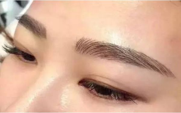 何晉龍磨骨成功，面容煥然一新！讓人難以置信的手術(shù)效果！