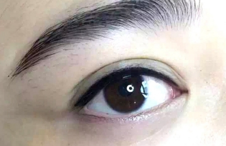 萊州市人民醫(yī)院整形科是不是值得信賴(lài)？整形效果如何？