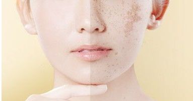 重慶新銅雀臺(tái)整形美容醫(yī)院褚健醫(yī)生的面部填充技術(shù)及真實(shí)案例分享