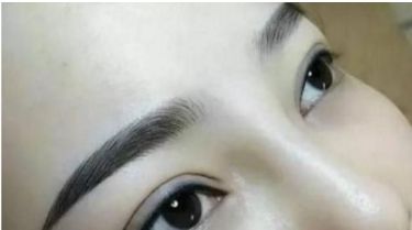 河北哪家醫(yī)院有好的雙眼皮手術(shù)推薦，整形醫(yī)院名單分享~