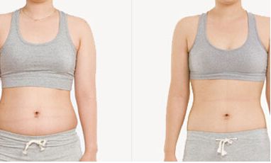 協(xié)和醫(yī)院提供熱瑪吉和超生炮手術(shù)，專家推薦！手術(shù)費(fèi)用一覽表僅參考！