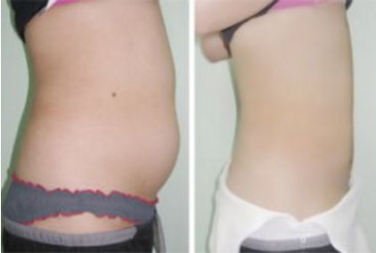 長沙哪家拉皮手術(shù)醫(yī)院靠譜？幾家實力口碑不錯，快來看看