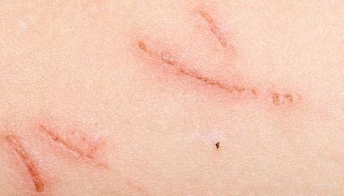 南京華美美容醫(yī)院引薦專業(yè)吸脂醫(yī)生