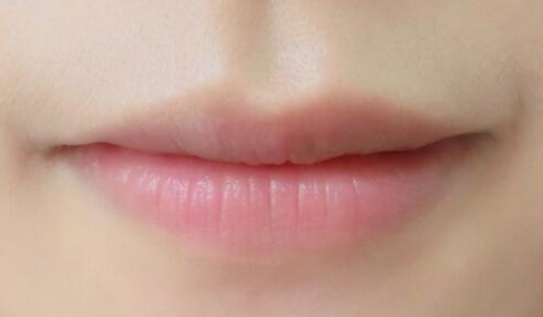 2023年成都十大玻尿酸醫(yī)院匯總，口碑如何？價格合理嗎？術后效果值得期待嗎？