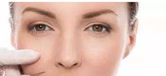 浙醫(yī)二院薛旦雙眼皮效果及價(jià)格詳情，醫(yī)生特長與病例分享