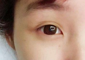 2023寧波隆鼻醫(yī)生排行榜：張廣巍、任森洋、肖慶華五位備受矚目的醫(yī)師解析及收費(fèi)信息！