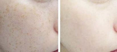 2023昆明下頜角整形臉部護理達人該怎么樣選擇？陳曦、錢靜、楊保祥等讓您信賴！