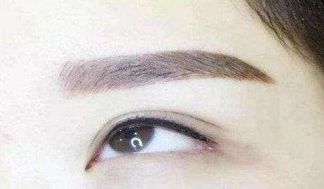 咨詢陳曉勇醫(yī)生雙眼皮手術效果如何？親身經(jīng)歷分享一覽