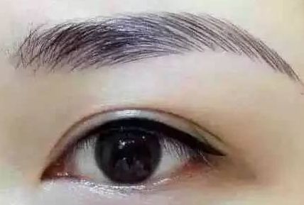 各路醫(yī)生實(shí)力大比拼！同帥與楊亞益，誰(shuí)在雙眼皮手術(shù)上更出彩？