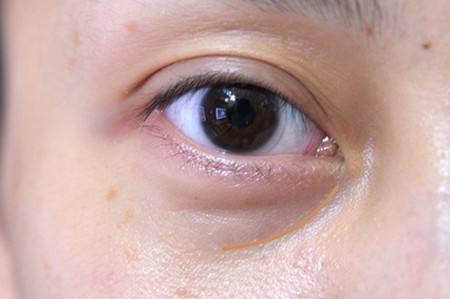 深圳北大醫(yī)院美容皮膚科的詳細資料是什么？如何了解更多有關深圳北大醫(yī)院美容皮膚科的信息？