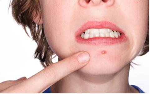 貴陽激光祛斑公立醫(yī)院哪家費用透明可信賴？2023更全排行榜！