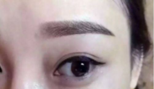 鄭州哪家整形醫(yī)院排名前五，取出異物效果好