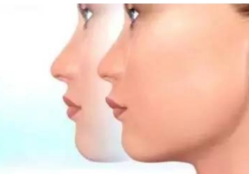 鹽城哪個(gè)醫(yī)院的光纖激光治療疤痕效果好？2023年鹽城光纖激光治療疤痕醫(yī)院排名榜TOP10！