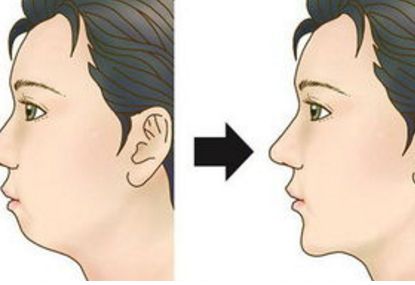 全國頂尖的鼻整復(fù)醫(yī)生排行榜