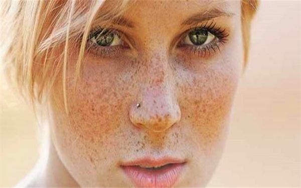 王振軍雙眼皮修復(fù)獨(dú)特個(gè)案分享，展現(xiàn)多款風(fēng)格圖片！