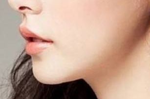 2023天津雙眼皮修復：醫(yī)生排名與技術(shù)對比，袁強、衛(wèi)星、李小兵等人誰更優(yōu)秀？