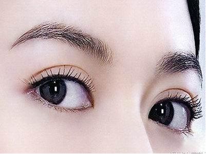 體驗廣州韓后整形醫(yī)院雙眼皮術(shù)效果，看看2023真人案例如何