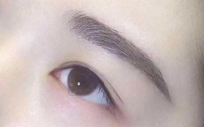 成都蔡震做聽力整形手術(shù)的效果與收費(fèi)情況揭秘