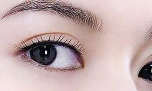 太玲美眸重現(xiàn)！揭秘雙眼皮新趨勢(shì)，驚艷效果讓人眼前一亮