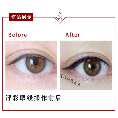 華美整形醫(yī)院在廣州口碑如何？高順福、袁耀東醫(yī)生值得信賴嗎？