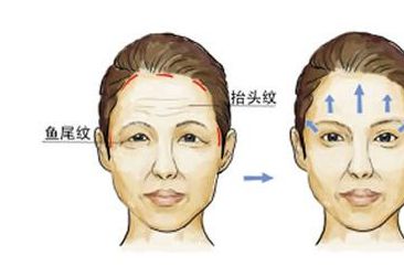 西京整形醫(yī)院：雙眼皮手術(shù)憑什么贏得專家認(rèn)可？親身經(jīng)歷分享