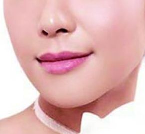 哪位西安醫(yī)生擅長割雙眼皮，割雙眼皮技術(shù)如何？