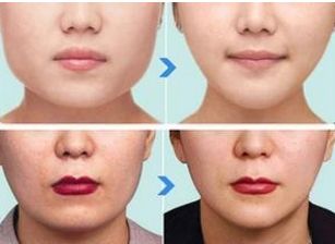 上海排名前十的公立美容醫(yī)院揭秘！技術(shù)、實(shí)力堪比私立！