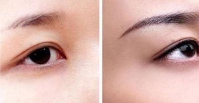 重慶頂尖眼部整形醫(yī)生、醫(yī)院排行榜一覽