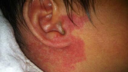 空軍總醫(yī)院整形科怎么樣？從隆鼻醫(yī)生到科普分享，真的那么靠譜嗎？