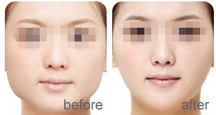 寧波美萊醫(yī)療美容專科的評(píng)價(jià)如何？全面解析李斌醫(yī)生的口碑反響！