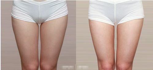 蘭州市口碑最佳醫(yī)美醫(yī)院綜合排名前三強(qiáng)勢(shì)揭曉