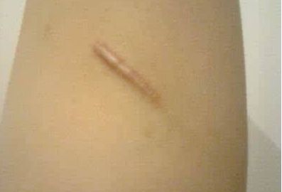 重慶最佳專業(yè)雙眼皮手術(shù)，醫(yī)生名單與真實(shí)案例圖震撼揭秘