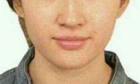 曹衛(wèi)剛vs.張超，比一比！探討九院兩位實力整形醫(yī)生的特長對比