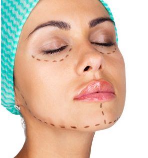 最新資訊！沈干專業(yè)雙眼皮技術揭秘，真實案例解析！