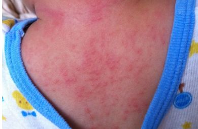 大家對重慶當代整形醫(yī)院醫(yī)生謝錦清的技術(shù)有何評價？附有最新隆鼻案例和醫(yī)療解析