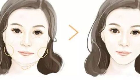 北京哪家整形醫(yī)院的隆鼻效果好？排行榜公開！