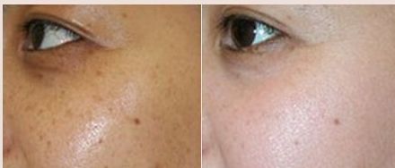 成都軍大整容醫(yī)院吸脂技術(shù)的價(jià)格對(duì)比及效果調(diào)查