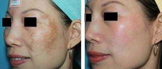 樂(lè)山整容醫(yī)院哪家效果好？專業(yè)對(duì)比與推薦！